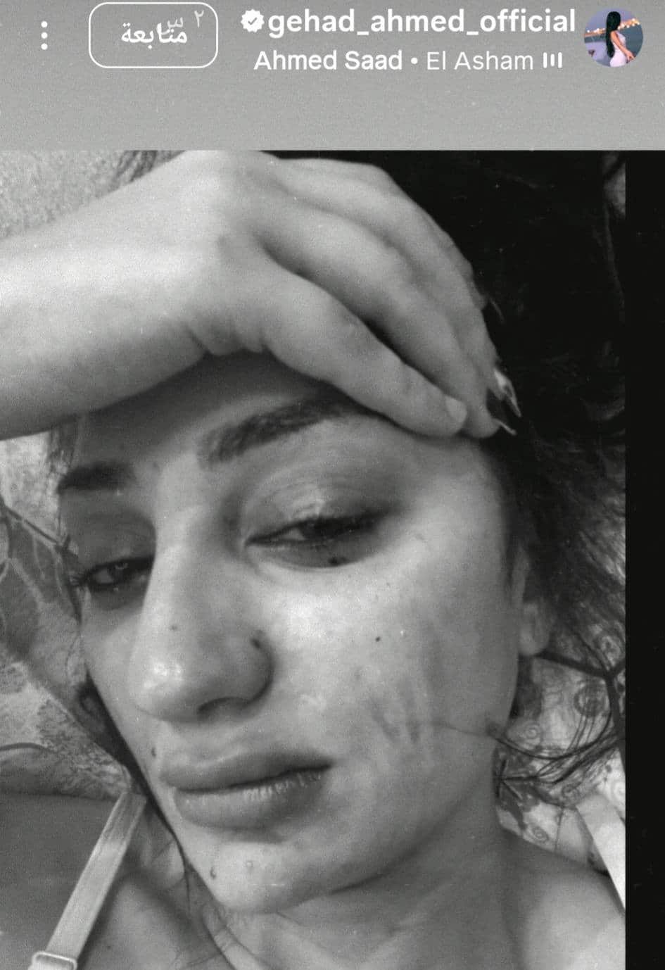 سبب انفصال عصام صاصا وزوجته.. الفستان الأصفر حديث السوشيال ميديا